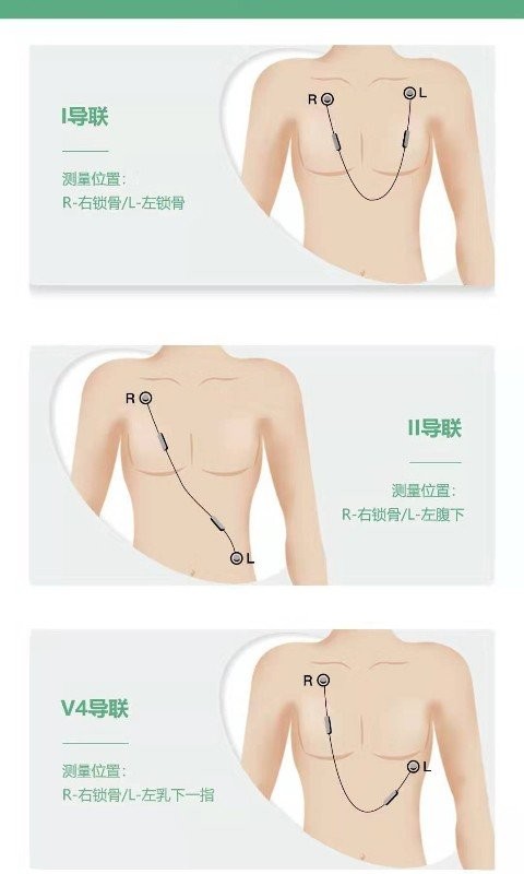 未然之光心眼官方版