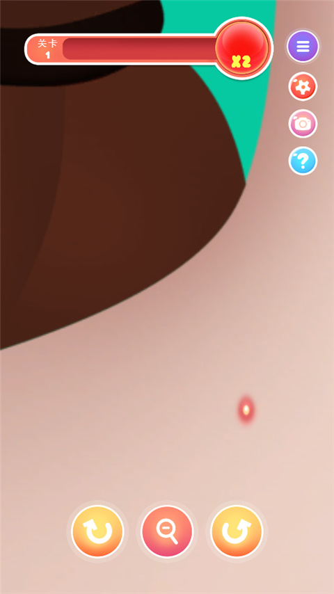挤痘痘达人游戏截图4
