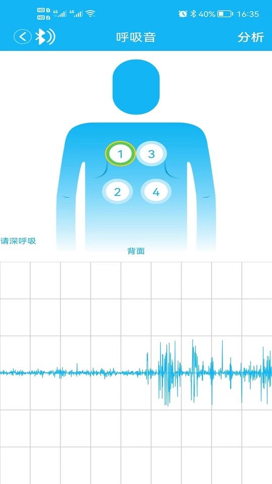 云听健康听诊器软件截图3