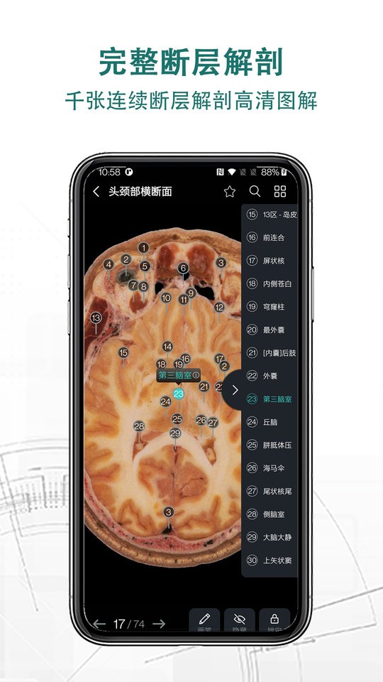 掌上3D解剖专业版截图2