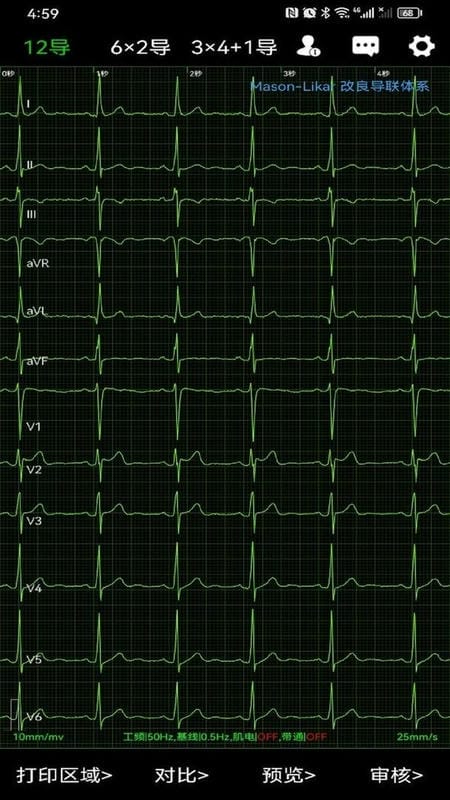 心电一张网官方版截图1