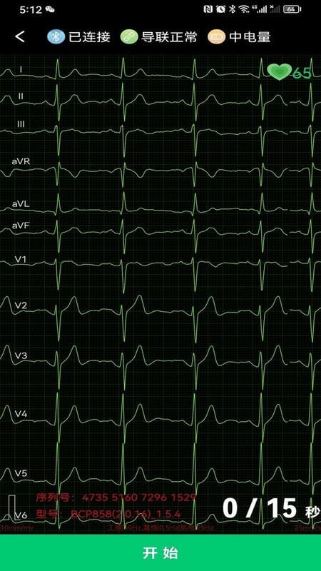 心电一张网官方版截图3
