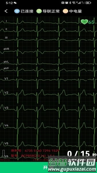 心电一张网app截图1