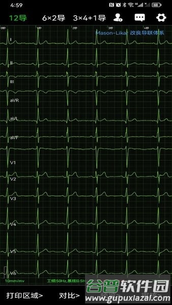 心电一张网app截图2