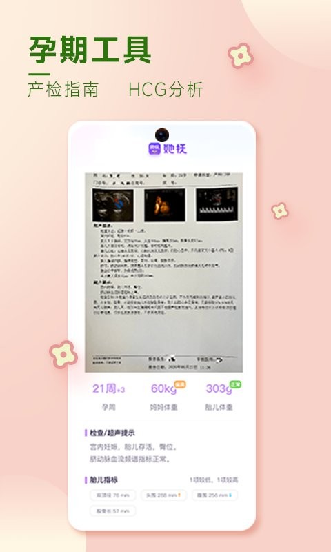 她抚孕育最新版截图1