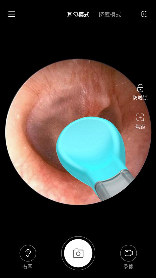 xlife智能可视采耳棒截图3