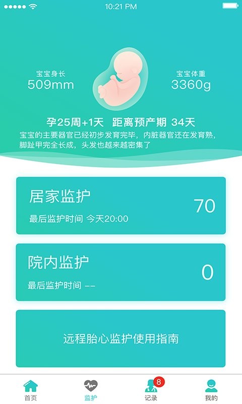 胎心监护最新版截图2