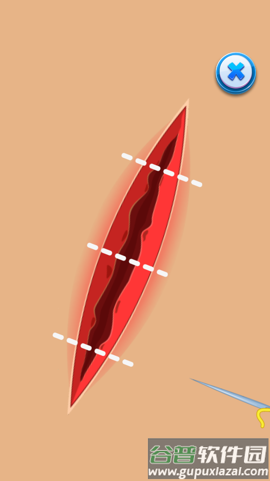 足部医生游戏(Foot Doctor)