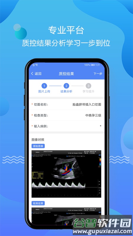超声智库APP