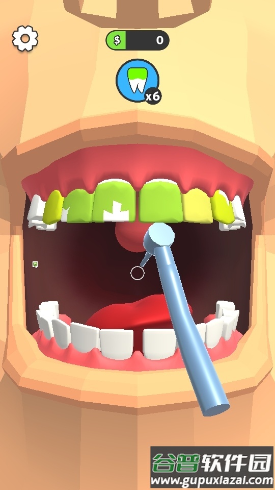 牙医也疯狂去广告版截图6