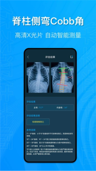 体态评估大师官方版截图3