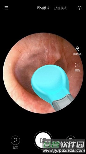 Xlife掏耳勺app截图3