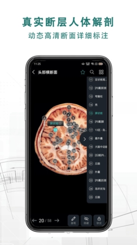 掌上3D解剖安卓版截图3