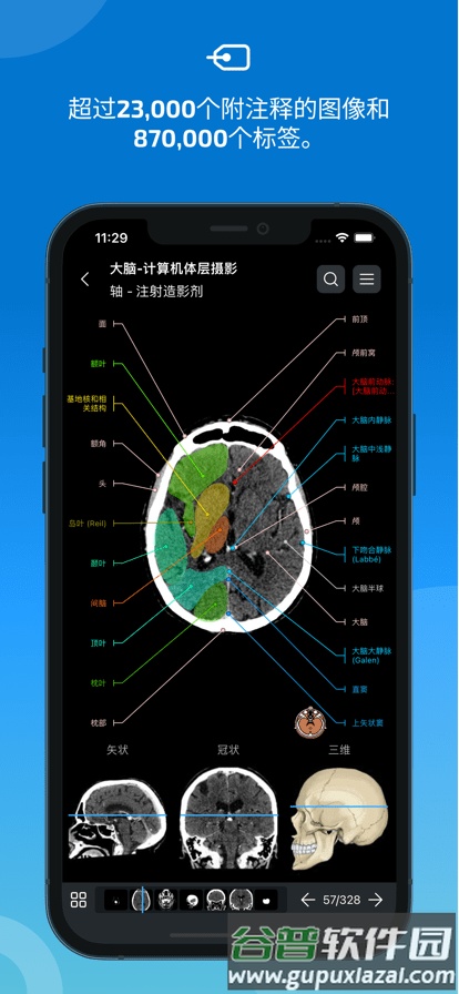 eAnatomy官方正版截图4