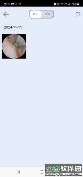 slvisual无线可视挖耳勺截图2