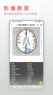 3Dbody解剖免费官网版 安卓版V8.8.41截图4