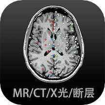 影像解剖图谱电子版高清版v4.5.5
