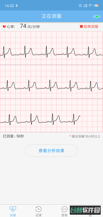 数维康心电截图2